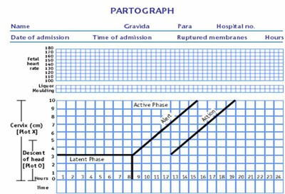 partograph